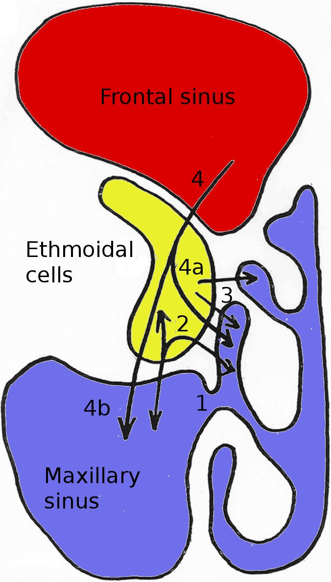 Sinus Drainage For Weeks at Sarah Travers blog