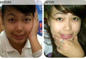 Bukti dan Testimoni Cream Walet Gold dan Serum Gold Bukti dan Testimoni Cream Walet Gold dan Serum Gold