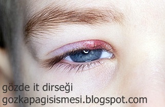 Arpacik Nedir Arpaciga Ne Iyi Gelir Saglik Haberleri