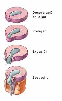 El tratamiento aumentado limfouzlov sobre el cuello el foro