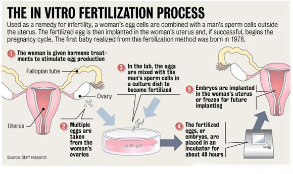 IVF Treatment in Madurai