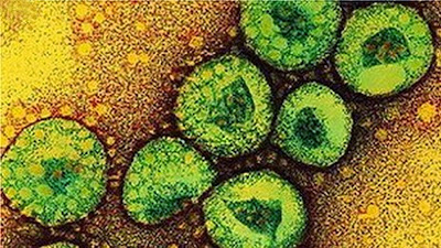 MERS - Middle Eastern Respiratory Syndrome MERS - Middle Eastern Respiratory Syndrome