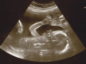 Baby Girl! Due January 31, 2012