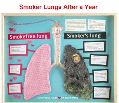 smokers lungs pictures | smokers lungs after a year | smokers lungs images