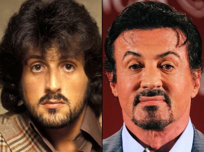 Chatter Busy Sylvester Stallone Plastic Surgery