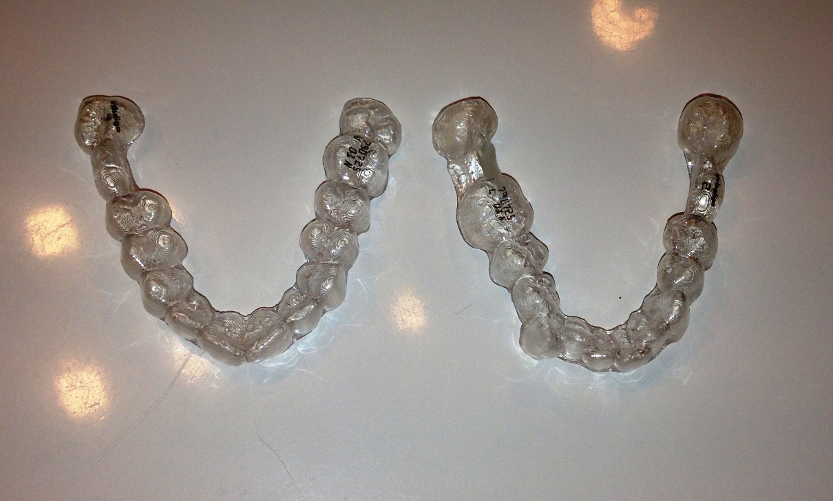 Sunshine! My Invisalign Experience The Beginning