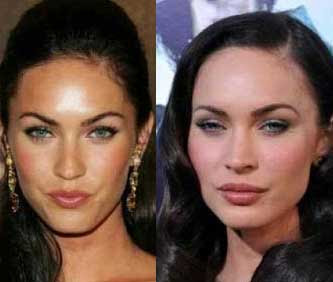 megan-fox-before-after-plastic-surgery.jpg