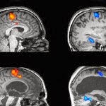 How Brain MRI Images Normal and Abnormal? - Tips Healthy Brain How Brain MRI Images Normal and Abnormal? - Tips Healthy Brain