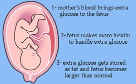 Gestational Diabetes Part One: The Diagnosis