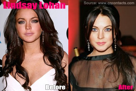 overdose celebrity contact lenses