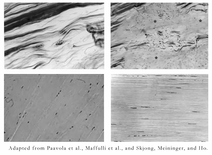 Jewel History The Royal Marriages 1818 The Court Jeweller