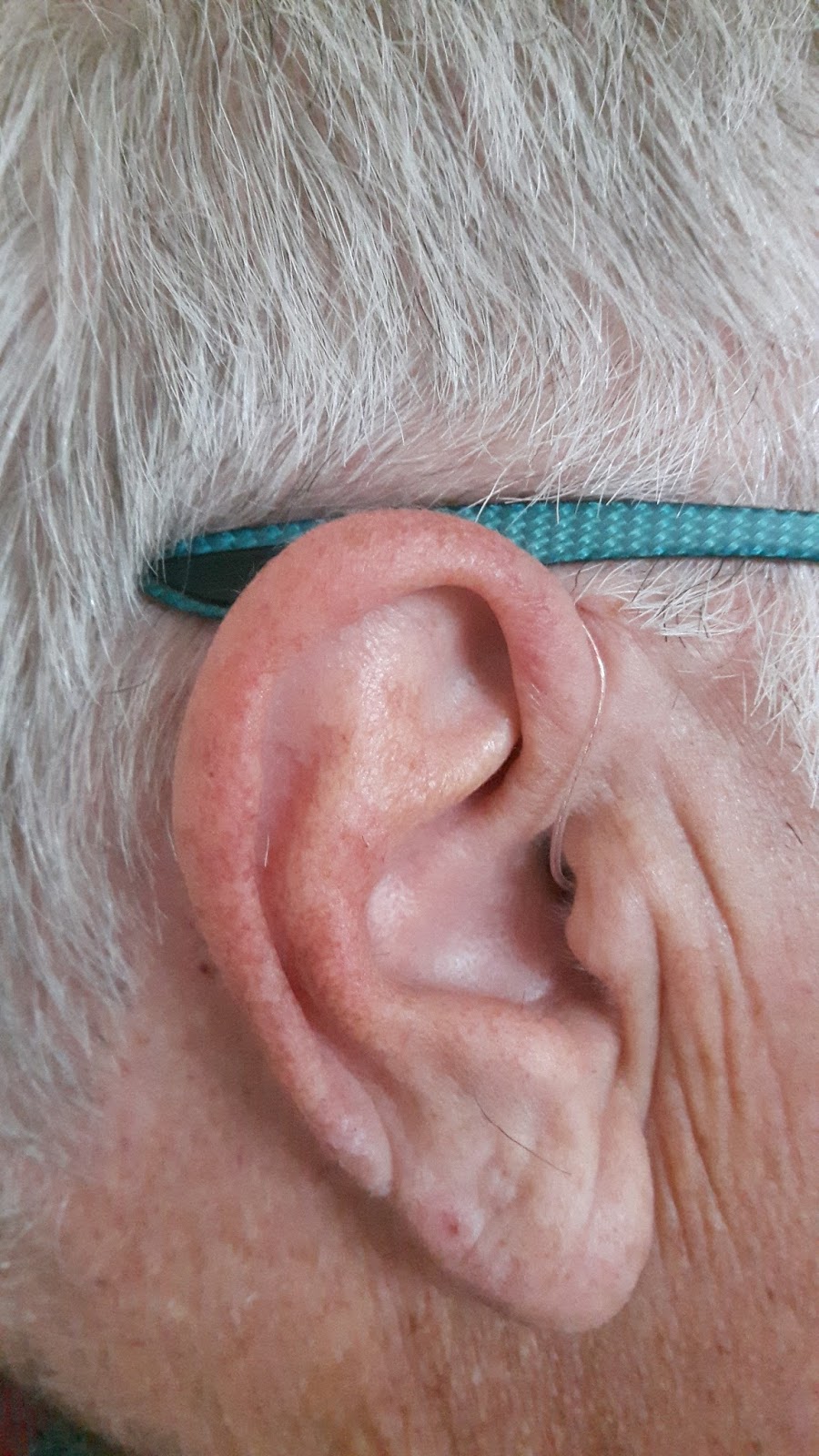 Consider you spectacles when you wear hearing aids (Barnsley man shows