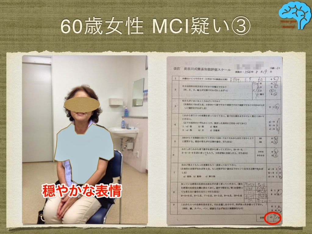 MCI(軽度認知機能障害)に対するフェルガードの効果を検証中 鹿児島認知症ブログ