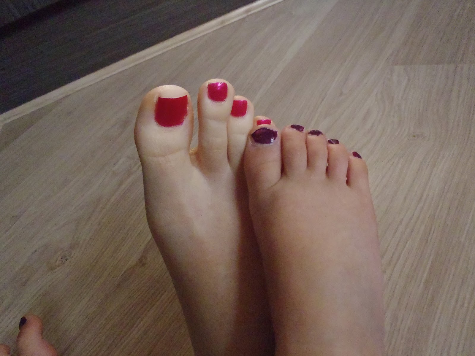 red sore toe