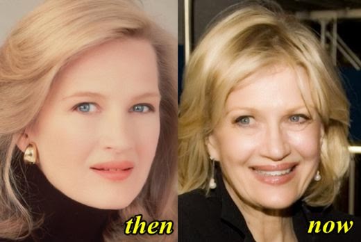 underage plastic surgery We asked a plastic surgeon in beverly hills to analyze the faces of every single member of bts is bts addicted to plastic surgery jungkook was 15 when he first debuted and was underage . underage plastic surgery We asked a plastic surgeon in beverly hills to analyze the faces of every single member of bts is bts addicted to plastic surgery jungkook was 15 when he first debuted and was underage .