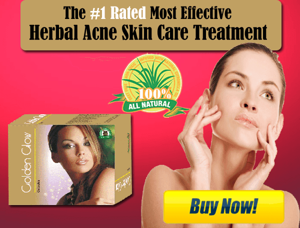 Herbal Acne Skin Care Treatment