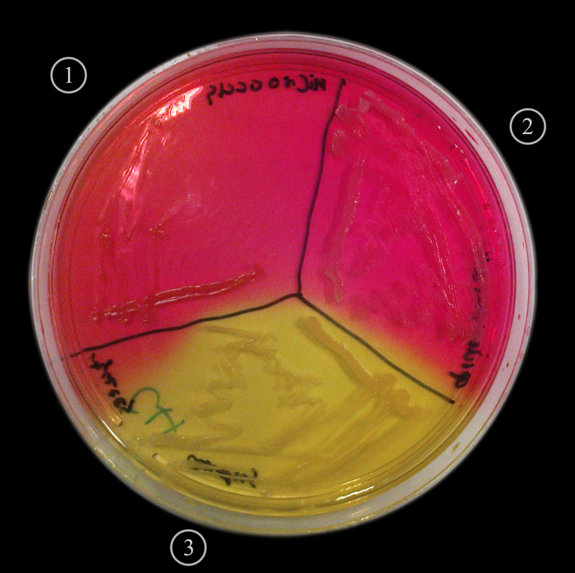 macconkey agar macconkey agar