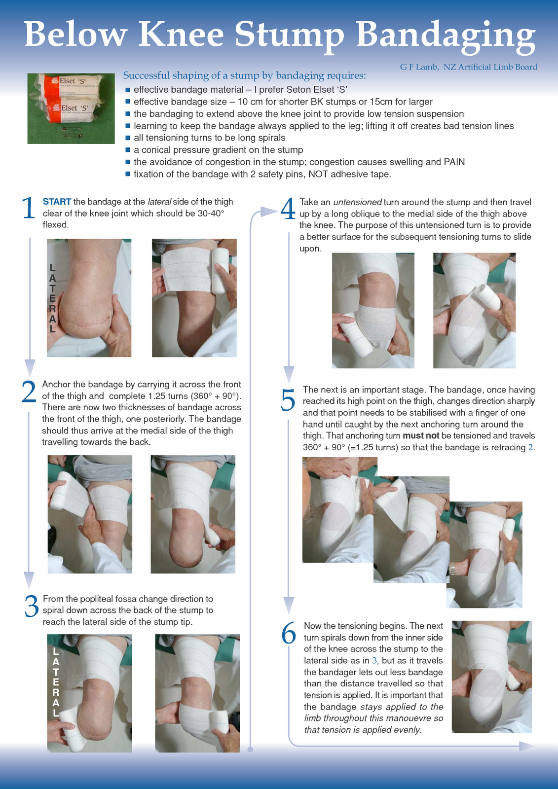 EXCLUSIVE PHYSIOTHERAPY GUIDE FOR PHYSIOTHERAPISTS STUMP BANDAGING FOR