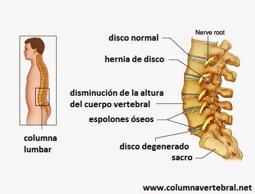 El corrector de la presencia para 6 años