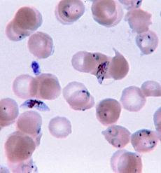 malaria image