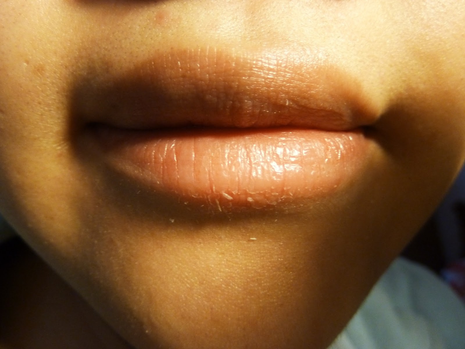 Solution to Chapped Lips Zowie Power