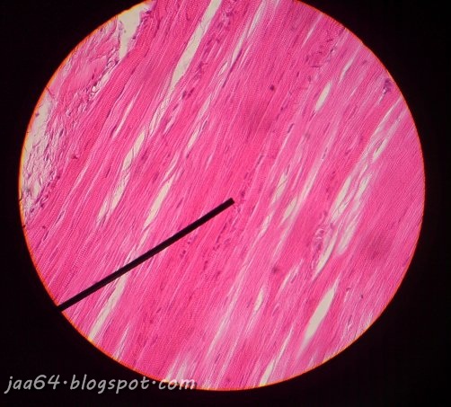 JaA's StorY practicum biology Block 3 ( epithelial and