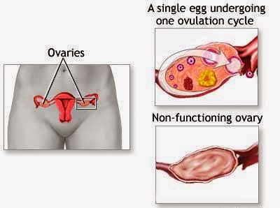 delayed pregnancy homeopathy treatment in chennai