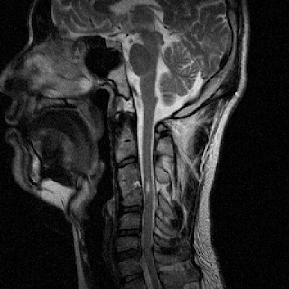 oro.dicom 0.3.3