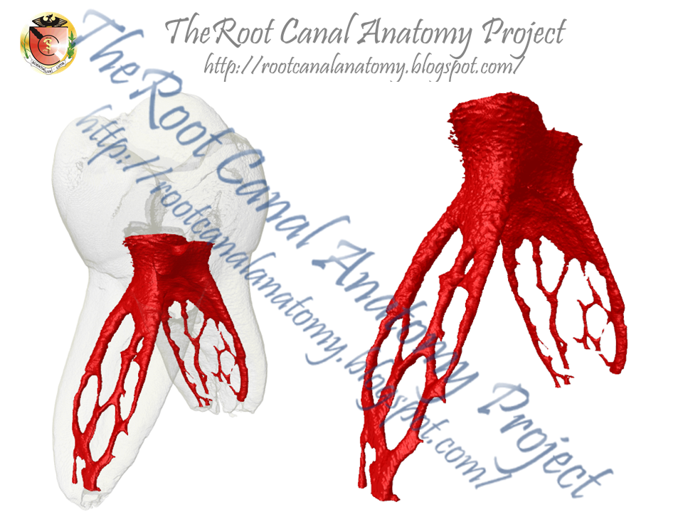 The Root Canal Anatomy Project October 2014