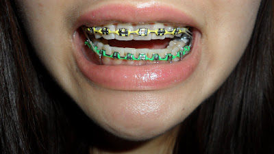 The function of the adjectives picturesque'' (line 7) picture