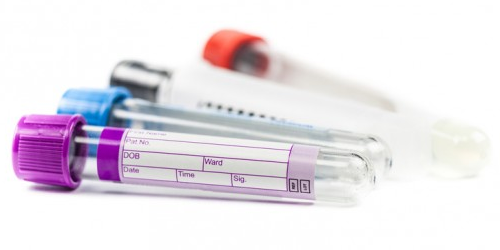 adrenal saliva test tubes adrenal saliva test tubes