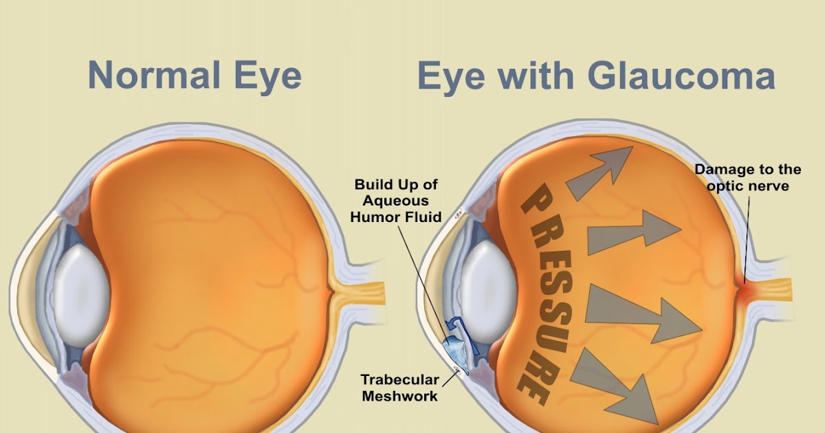 Eye Treatment to Protect Against Being Studied