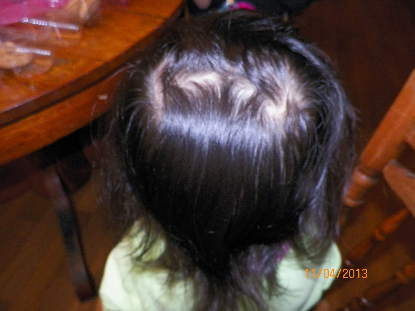 mygreatfinds: Both my daughters have double cowlicks/hair whorls!