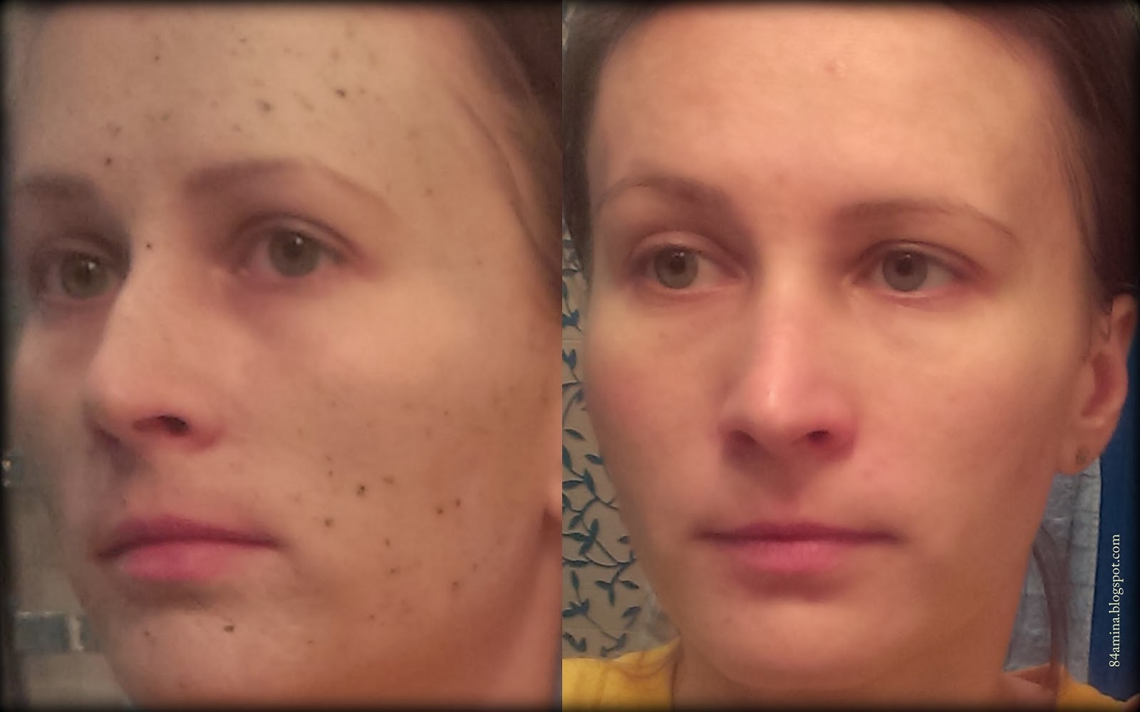 Amina Beauty One Earth Science, Gentle Skin Peel, PapayaGlycolic