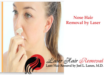 laser hair removal nose hair