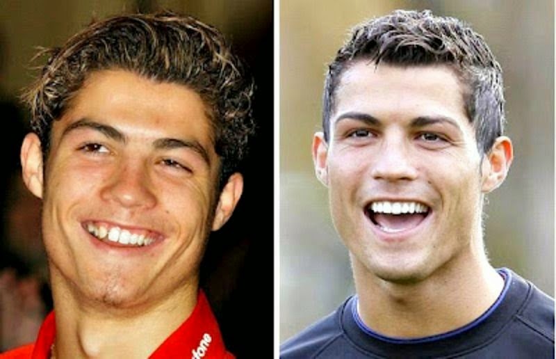 As Noticias Mais Bacanas Cristiano Ronaldo antes e depois da sua fama