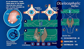 Reflejo Oculocefálico