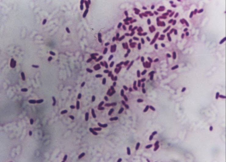 ATLAS DE BACTERIOLOGÍA CLÍNICA