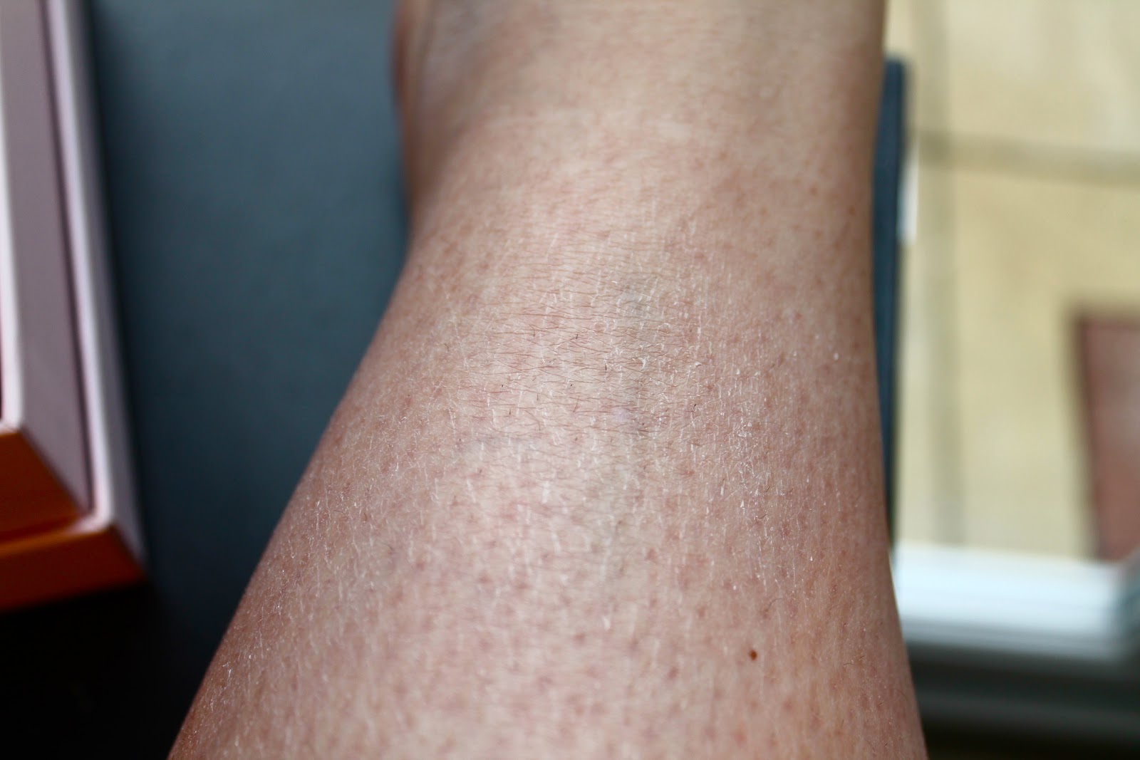 Round Dry Patch Of Skin On Thigh