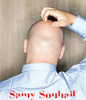 طرق طبيعية لمعالجة تساقط الشعر طرق طبيعية لمعالجة تساقط الشعر