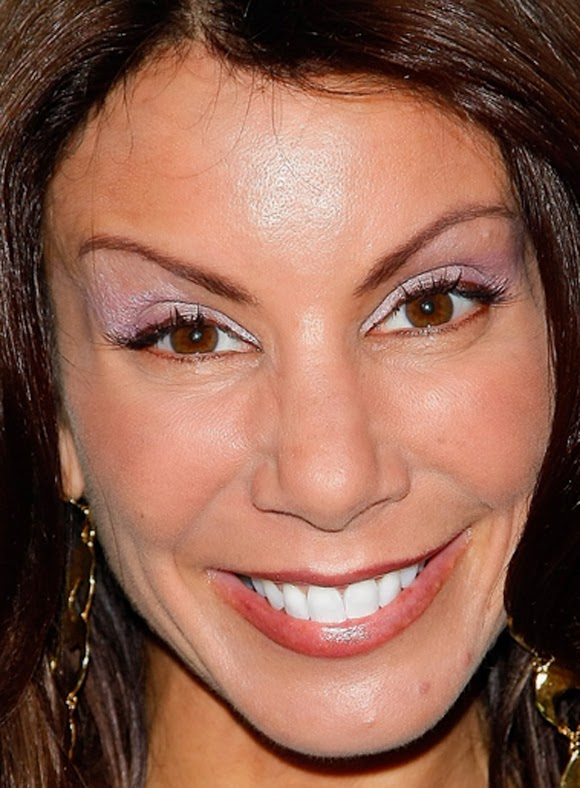 Has Danielle Staub had Plastic Surgery Before and After Botox