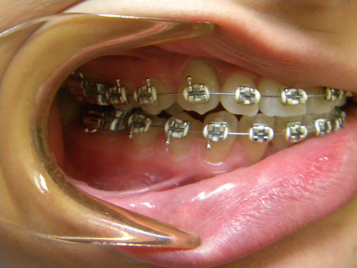 Practical Orthodontics More Questions And Answers