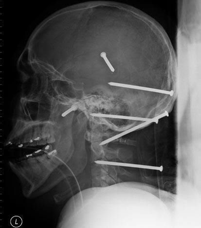 Holy Point Shot Socket Or Impale Dmg Holy Point Shot Socket Or Impale Dmg