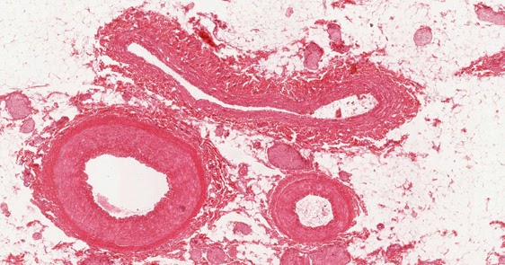 CLASS BLOG: BIO 202 Vessels WORKSHEET