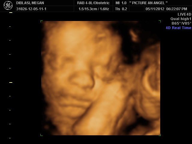 Hoping for Baby B 3D/4D Ultrasound
