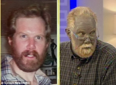 colloidal silver blue man dies colloidal silver blue man dies