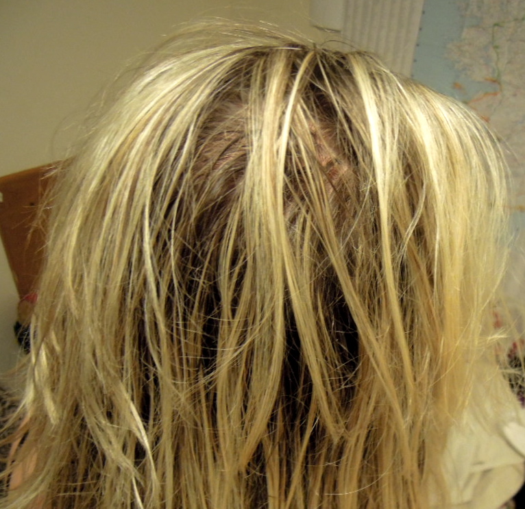 No 'Poo Day 10 117 Days Away