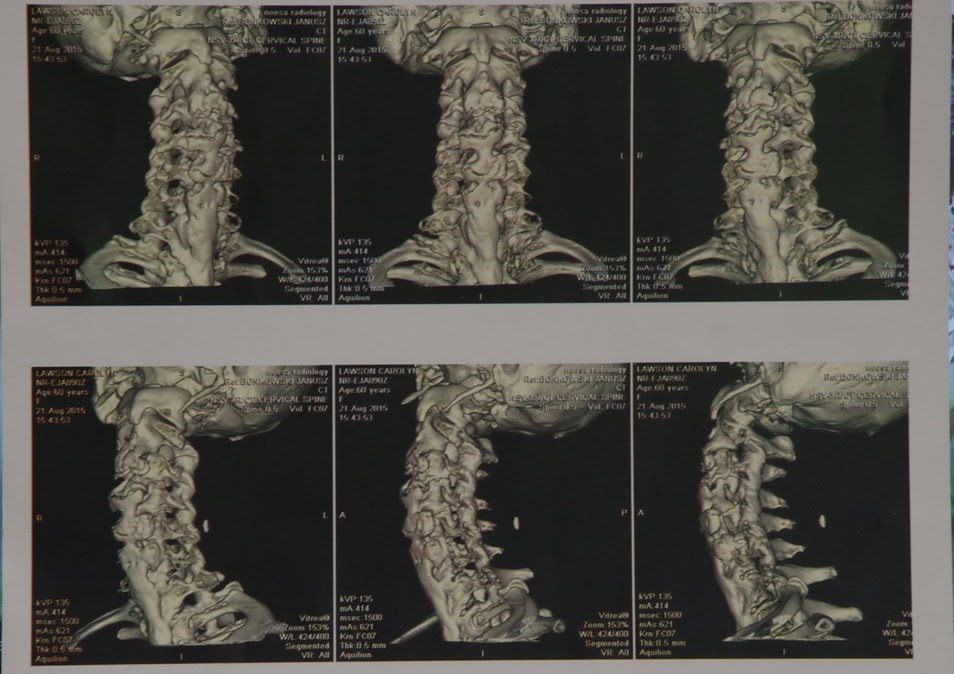 FORESTIERDISH LE BLOG