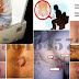Bebas Wasir Ambeien dengan Ambeclear De Nature thumbnail