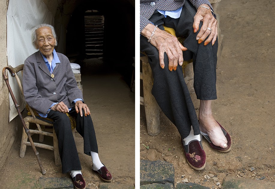 Deformutilation Chinese Foot Binding II